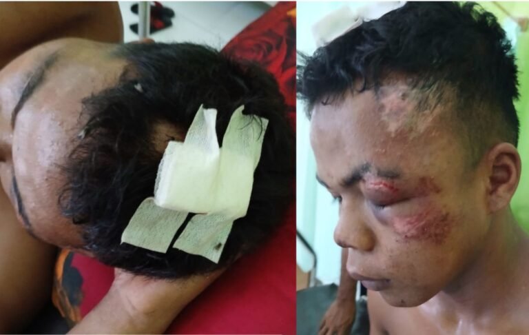 Brutal! Pemuda di Siompu Barat Babak Belur Dikeroyok di Pesta Joget